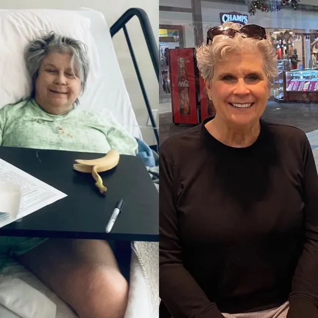 Before and after: the same woman, in a hospital bed, then smiling at a shopping centre