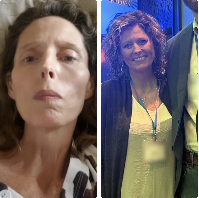 Before and after: the same woman, pale and lying down, then smiling at a NeoLife event